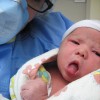 Cesarean Child Birth