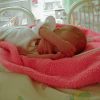 Preeclampsia Baby